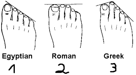 脚趾的样子能看出女人性格1
