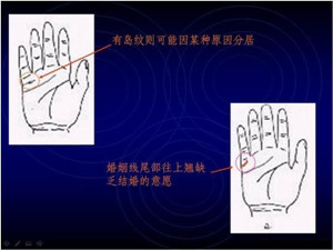 手掌纹与健康，看手掌纹知健康11